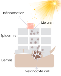 inflammation causing pigmentation